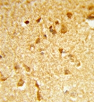 AP51217PU-N - DDX17