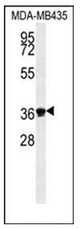 AP51235PU-N - Exonuclease V