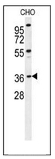 AP51235PU-N - Exonuclease V