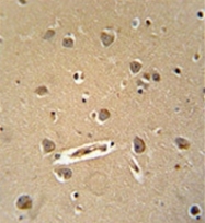 AP51241PU-N - MGC24039