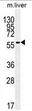 AP51252PU-N - 7-DHC reductase
