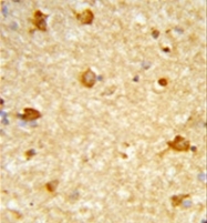 AP51265PU-N - DIRAS1