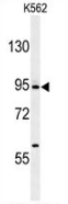 AP51275PU-N - Delta-like protein 4 / DLL4