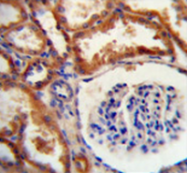 AP51293PU-N - DNAJC22