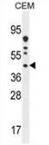 AP51293PU-N - DNAJC22
