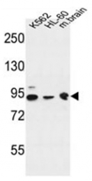 AP51296PU-N - DNAJC6