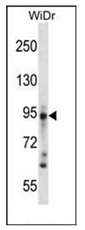 AP51324PU-N - Desmoglein-3