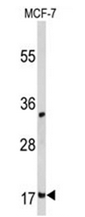 AP51327PU-N - Destrin