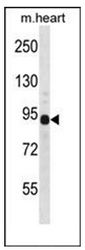 AP51329PU-N - DTNA / DRP3