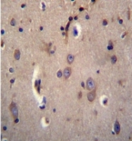 AP51329PU-N - DTNA / DRP3