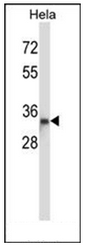 AP51331PU-N - Dysbindin