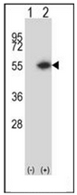 AP51331PU-N - Dysbindin