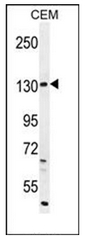 AP51336PU-N - Dual oxidase 2
