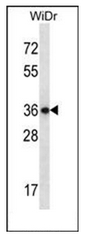 AP51354PU-N - E2F-associated phosphoprotein