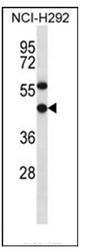 AP51355PU-N - EBNA1BP2