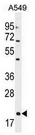 AP51364PU-N - Endothelin-1