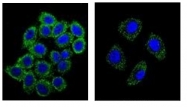 AP51364PU-N - Endothelin-1