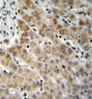 AP51365PU-N - Endothelin-1