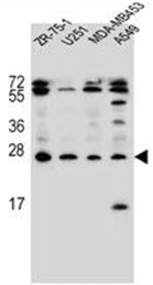 AP51365PU-N - Endothelin-1