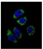 AP51365PU-N - Endothelin-1