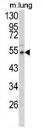 AP51374PU-N - Fibulin-3