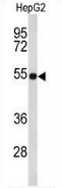 AP51375PU-N - Fibulin-4