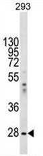 AP51391PU-N - EIF2B1 / EIF2BA