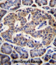 AP51403PU-N - EIF4H / WBSCR1