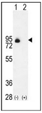 AP51429PU-N - CD105 / Endoglin