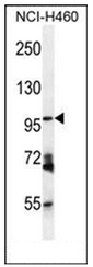 AP51433PU-N - CD249 / Glutamyl aminopeptidase