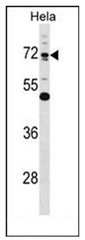 AP51445PU-N - Epsin-1