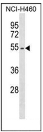 AP51446PU-N - Erythropoietin receptor