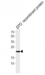 AP51461PU-N - Erythropoietin / EPO