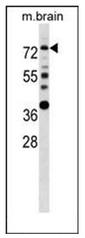 AP51464PU-N - Estrogen receptor alpha