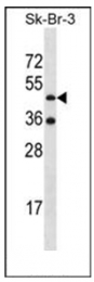 AP51469PU-N - Ethanolamine kinase 2