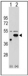 AP51469PU-N - Ethanolamine kinase 2