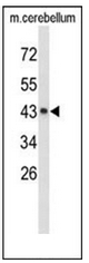 AP51485PU-N - Exostosin-like 2