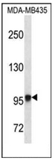 AP51486PU-N - Exostosin-like 3