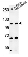 AP51487PU-N - Exostosin-like 3