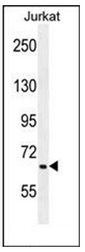 AP51492PU-N - Coagulation factor XI (F11)