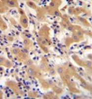 AP51492PU-N - Coagulation factor XI (F11)