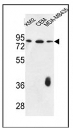 AP51493PU-N - Coagulation factor XII (F12)
