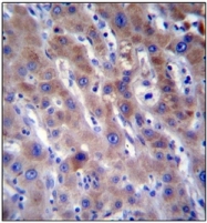 AP51507PU-N - FADS2