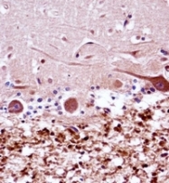 AP51609PU-N - XRCC9 / FANCG