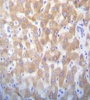 AP51612PU-N - FAST kinase