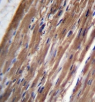 AP51614PU-N - FBLIM1