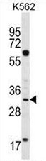 AP51643PU-N - Ficolin-3