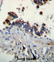 AP51643PU-N - Ficolin-3