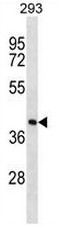 AP51646PU-N - FPP synthetase