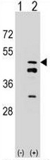 AP51646PU-N - FPP synthetase